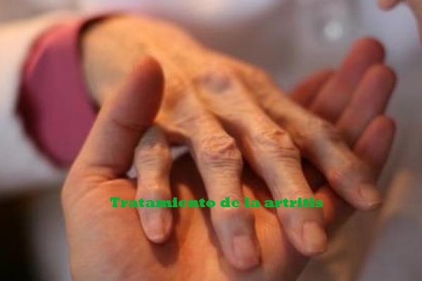Tratamiento de la artritis